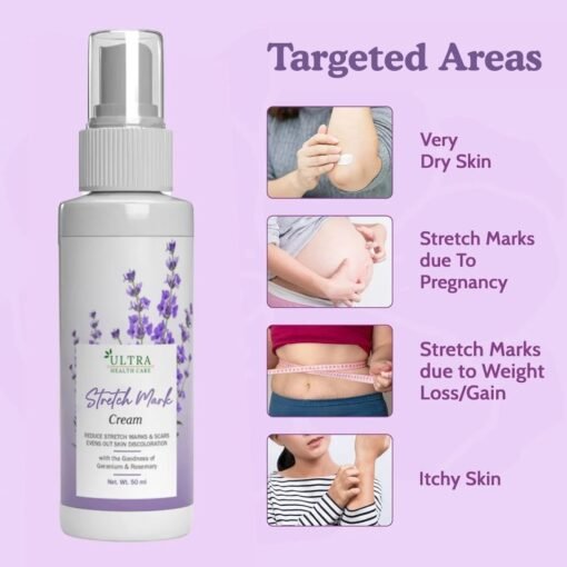 Stretch mark cream best for