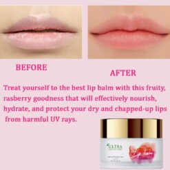 best lip balm for dry lips