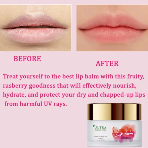 best lip balm for dry lips