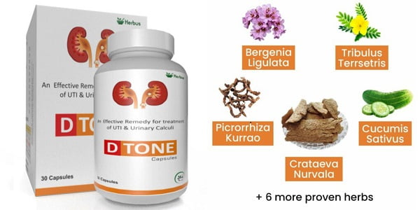 d tone kidney stone