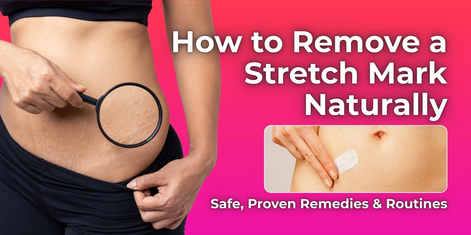 How to Remove a Stretch Mark Naturally